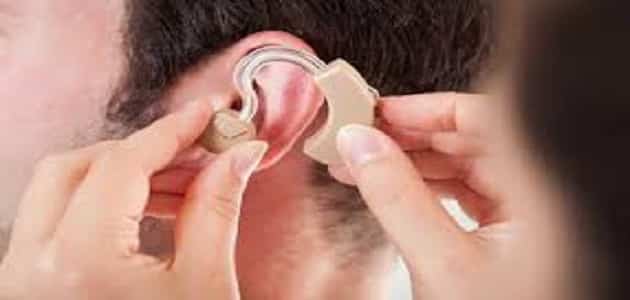 بحث عن الإعاقة السمعية مع المراجع